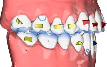 model-tooth